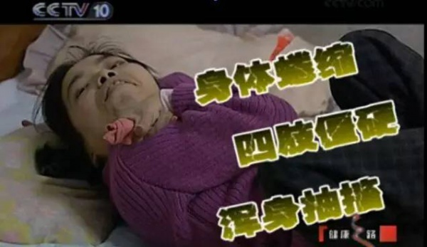 集美人注意！最近千萬(wàn)別吃它，比毒蛇還毒！目前尚無(wú)特殊療法！