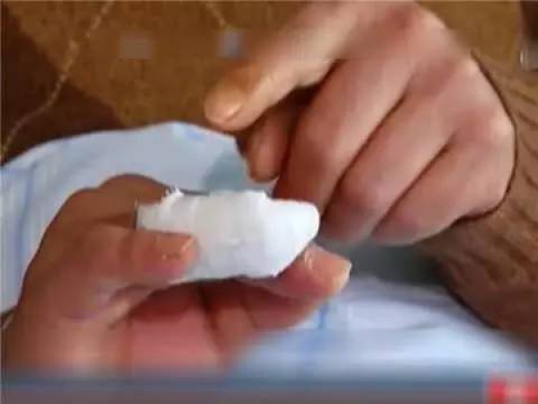 后怕！小伙擠個痘痘，擠出高燒、眼睛肺部嚴重感染送進醫(yī)院…你可能也經(jīng)常這樣做