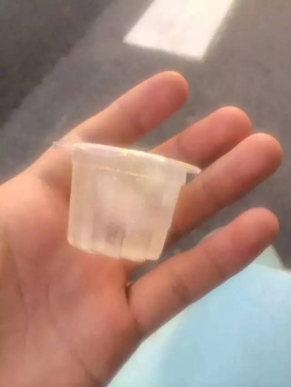 7歲男孩被果凍噎得臉發(fā)黑，倒地昏迷！這個急救法家長一定要學(xué)會
