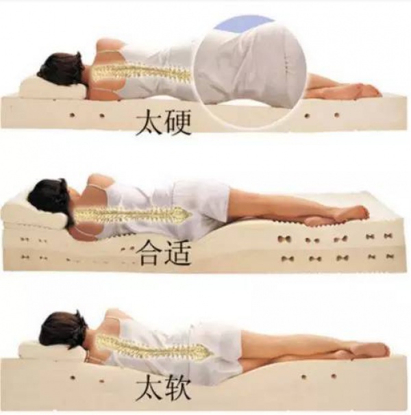 聽醫生的“睡硬板床”反而腰更痛？因為你理解錯了！正確睡法在這里