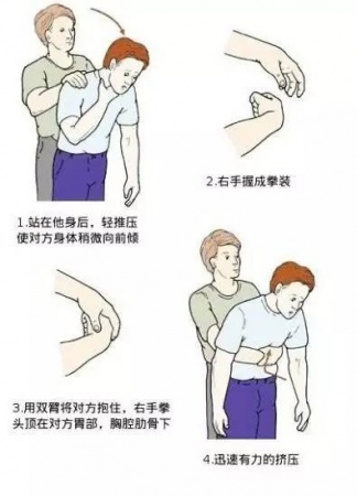 這九個日常急救常識竟然都是錯的！家長教過，影視劇里也常見