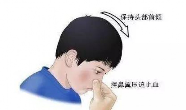 這九個日常急救常識竟然都是錯的！家長教過，影視劇里也常見