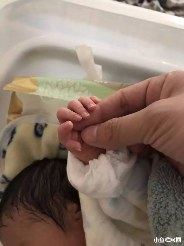 福建一產婦孕期產檢全正常，嬰兒生下來后卻發現有6種畸形！關于產檢，這些你必須知道！