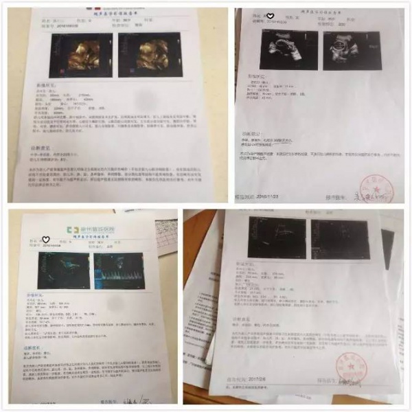 福建一產婦孕期產檢全正常，嬰兒生下來后卻發現有6種畸形！關于產檢，這些你必須知道！