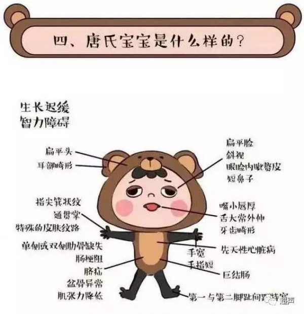 福建一產婦孕期產檢全正常，嬰兒生下來后卻發現有6種畸形！關于產檢，這些你必須知道！