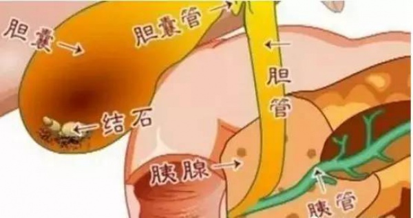 30多歲切除膽囊，原北大醫院院長：這些習慣很要命！年輕人幾乎條條都中